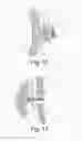 Fig. 08 - Device for external orthopedic fixations