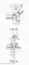 Fig. 09 - Device for external orthopedic fixations