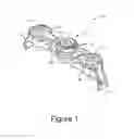 Fig. 02 - TRANSVERSE VERTEBRAL CONNECTOR