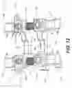 Fig. 09 - Expandable spinal fixation system