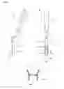 Fig. 06 - Vertebral surgery instrument