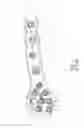Fig. 02 - Bone plate with alternating chamfers