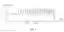 Fig. 06 - Radiofrequency ablation electrode needle