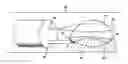 Fig. 01 - Endoscopic resection method
