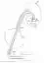 Fig. 01 - Medical device and methods of use
