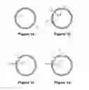 Fig. 02 - Brain shift compensation for catheter trajectory planning