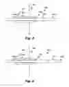 Fig. 06 - Catheter movement control