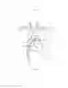 Fig. 158 - Robotic catheter system