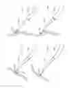 Fig. 167 - Robotic catheter system