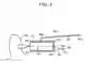 Fig. 07 - Soft tissue fixation repair methods using tissue augmentation scaffolds