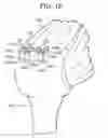 Fig. 22 - Soft tissue fixation repair methods using tissue augmentation scaffolds