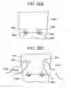 Fig. 65 - Soft tissue fixation repair methods using tissue augmentation scaffolds