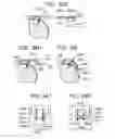 Fig. 76 - Soft tissue fixation repair methods using tissue augmentation scaffolds