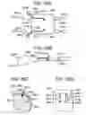 Fig. 77 - Soft tissue fixation repair methods using tissue augmentation scaffolds