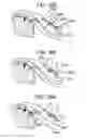 Fig. 80 - Soft tissue fixation repair methods using tissue augmentation scaffolds