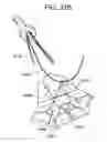 Fig. 83 - Soft tissue fixation repair methods using tissue augmentation scaffolds