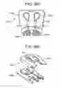 Fig. 89 - Soft tissue fixation repair methods using tissue augmentation scaffolds
