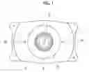 Fig. 02 - PHAKIC INTRAOCULAR LENS