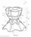 Fig. 02 - Devices for reducing left atrial pressure having biodegradable constriction, and methods of making and using same