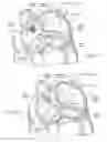 Fig. 07 - Devices, systems, and methods for reshaping a heart valve anulus, including the use of a bridge implant having an adjustable bridge stop
