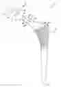 Fig. 01 - Orthopaedic surgical instrument system and method for protecting a femoral stem taper