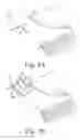 Fig. 03 - Orthopaedic surgical instrument system and method for protecting a femoral stem taper