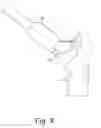 Fig. 07 - Orthopaedic surgical instrument system and method for protecting a femoral stem taper