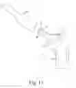 Fig. 09 - Orthopaedic surgical instrument system and method for protecting a femoral stem taper