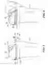 Fig. 04 - Edge-Matched Articular Implant