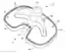 Fig. 01 - Tibial component with enhanced radial cement fixation