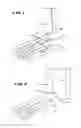Fig. 02 - Systems and methods for installing ankle replacement prostheses