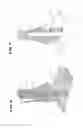 Fig. 06 - Systems and methods for installing ankle replacement prostheses