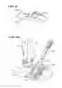 Fig. 08 - Systems and methods for installing ankle replacement prostheses