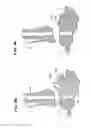 Fig. 09 - Systems and methods for installing ankle replacement prostheses