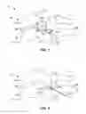 Fig. 02 - Cervical distraction method