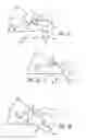 Fig. 09 - Geared cam expandable interbody implant and method of implanting same