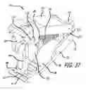 Fig. 20 - Geared cam expandable interbody implant and method of implanting same