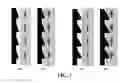Fig. 02 - METHODS AND APPARATUS FOR INCREASING THE PROXIMAL MOVEMENT OF BLOOD OR LYMPH
