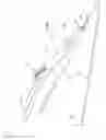 Fig. 02 - Operating handle and stent delivery system