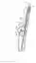 Fig. 09 - Operating handle and stent delivery system