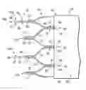 Fig. 01 - Systems and methods for deploying a portion of a stent using an auger-style device