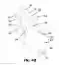 Fig. 06 - ANTI-MIGRATION STENT DEPLOYMENT DELIVERY SYSTEMS AND METHODS