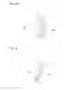 Fig. 12 - Adhesive plaster structure for treating wounds caused by ingrown nails