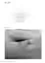 Fig. 28 - Adhesive plaster structure for treating wounds caused by ingrown nails