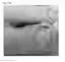 Fig. 32 - Adhesive plaster structure for treating wounds caused by ingrown nails