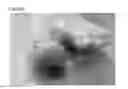 Fig. 47 - Adhesive plaster structure for treating wounds caused by ingrown nails
