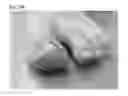 Fig. 49 - Adhesive plaster structure for treating wounds caused by ingrown nails