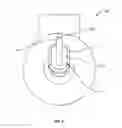 Fig. 03 - Cannula for external drainage of subretinal fluid