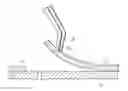Fig. 01 - Intraocular device for dual incisions