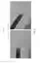 Fig. 07 - Intraocular device for dual incisions